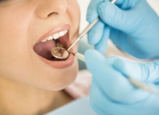 Saiba identificar quando é preciso procurar um dentista