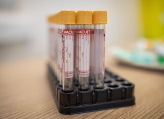 Estudo comprova que coronavírus afeta cérebro e detalha efeitos nas células nervosas