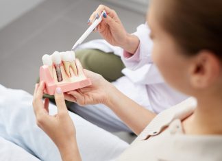 Popularização do acesso a implantes dentários promove mudanças em saúde bucal