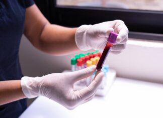 Julho Amarelo: campanha incentiva testagem contra hepatites virais