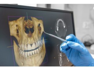 Exames odontológicos são cruciais para a saúde dental