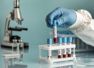 Precisão de exames é determinante para salvar vidas