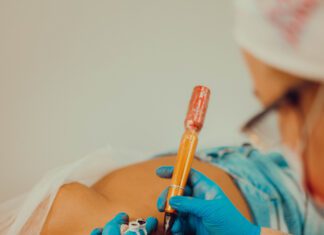 Tattoo Week SP: 10ª edição promove doação de micropigmentação paramédica